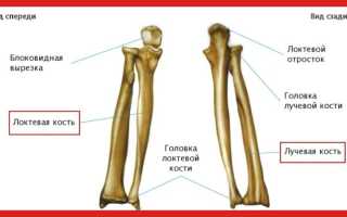 Как лечить вывих лучевой кости правильно и эффективно