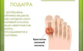 Психосоматика подагры: причины и последствия