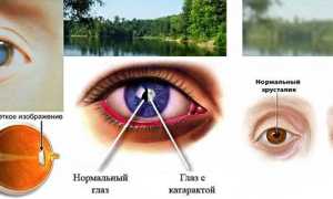 Глазные капли «Тауфон»: аналоги, инструкция, отзывы