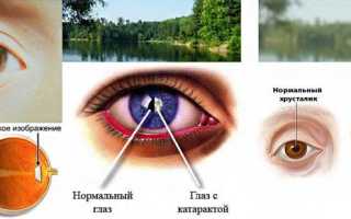 Глазные капли «Тауфон»: аналоги, инструкция, отзывы