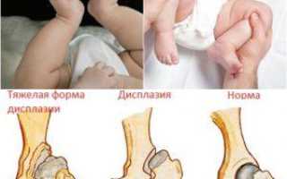 Что такое широкое пеленание и для чего оно применяется в уходе за новорожденными