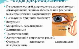 Воспаление слезного мешка: лечение в домашних условиях