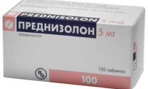 Причины, лечение и псоледствия височного артериита