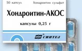 Самые эффективные хондропротекторы для суставов: обзор и рекомендации