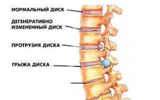 Какие витамины можно попить для укрепления костей и суставов для здоровья