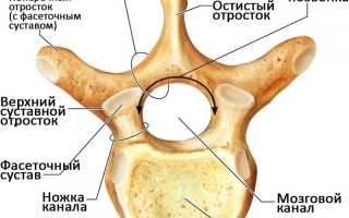 Как лечить фасеточный синдром эффективно и безопасно