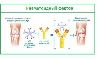 Что такое ревматоидный фактор и его значение