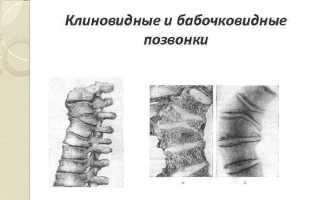 Что такое бабочковидный позвонок и его особенности