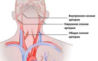 Левосторонний инсульт головного мозга – симптомы, последствия, прогноз