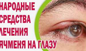 Основные способы, как избавится от ячменя на глазу
