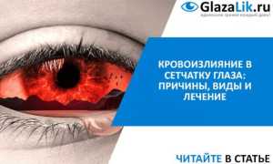 Причины и лечение кровоизлияния в глаз: что делать и как спасти зрение?