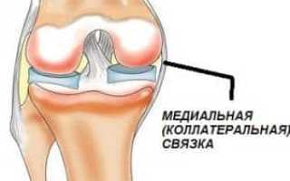 Как лечить растяжение связки коленного сустава правильно и эффективно