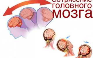 Сотрясение головного мозга: 8 симптомов, лечение (23 препарата) у взрослого и ребенка, первая помощь, последствия травмы