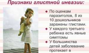 Как понять, что у тебя глисты: признаки и симптомы глистной инвазии