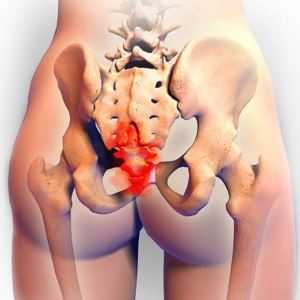 Что делать при ушибе копчика