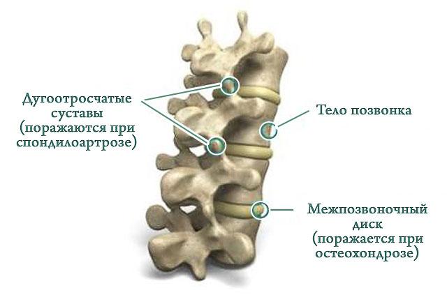Какое соединение между костями позвоночника