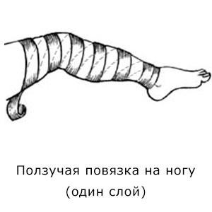 Как правильно бинтовать ноги эластичным бинтом