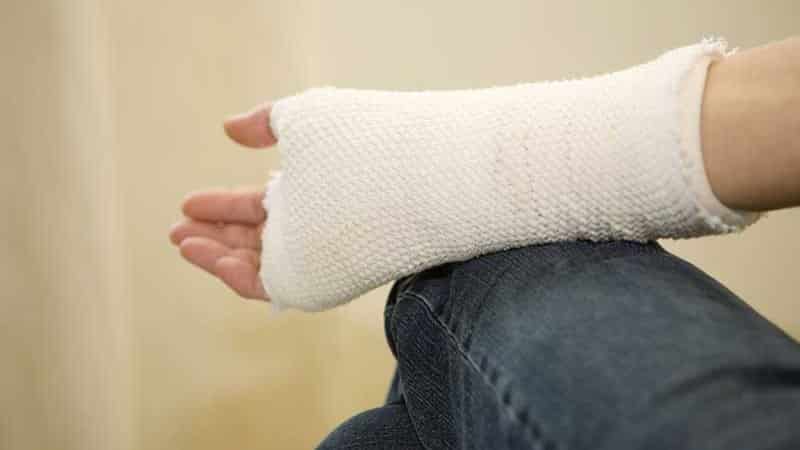 Что делать при вывихе кисти