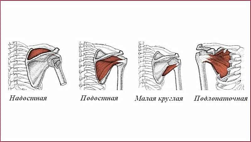 Как лечить повреждение сухожилия надостной мышцы плеча