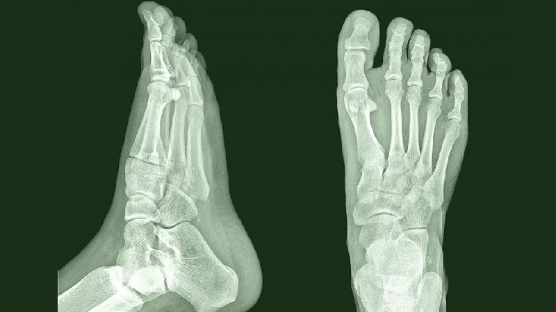 Как устроена стопа человека