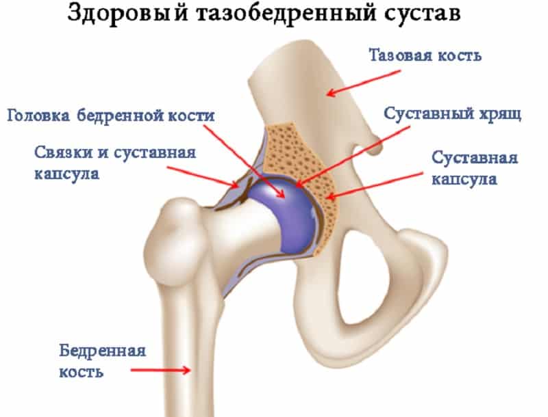 Что такое ацетабулярные углы