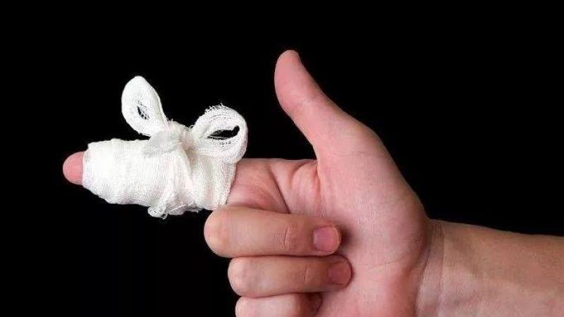 Что делать при переломе пальца на руке