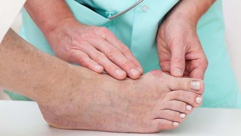 Как лечить перелом большого пальца ноги