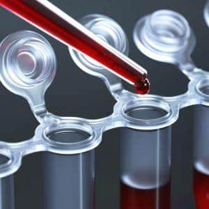 Как принимать препарат Трентал