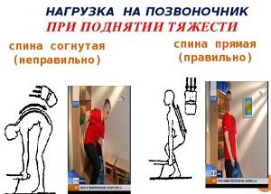 Что делать при обострении остеохондроза