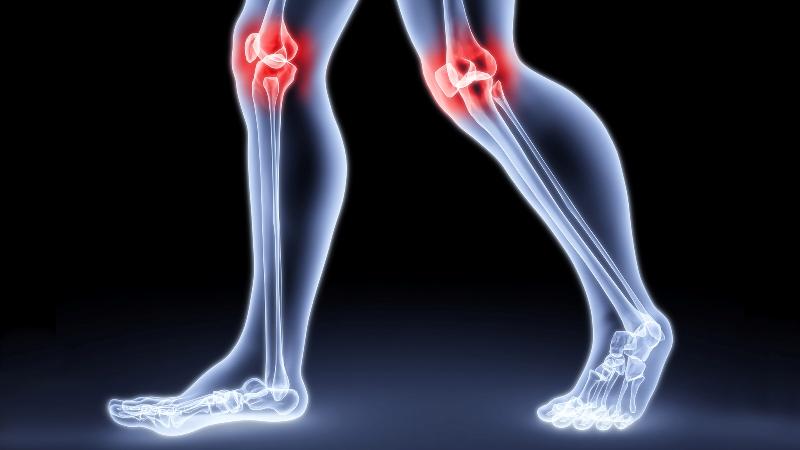 Что делать при вывихе колена