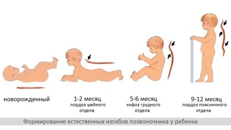 Как лечить лордоз поясничного отдела