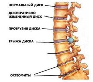 Как делают УЗИ позвоночника