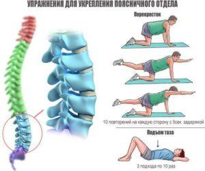 Как лечить перелом крестца