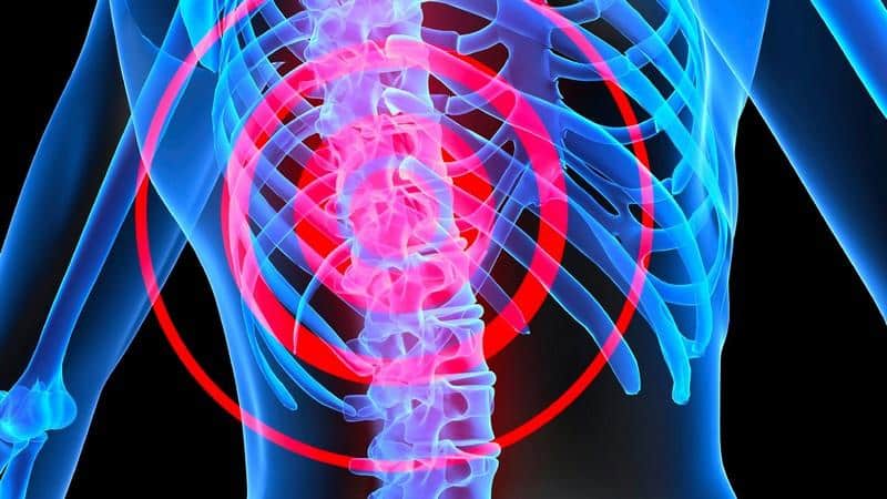 Как лечить перелом седалищной кости