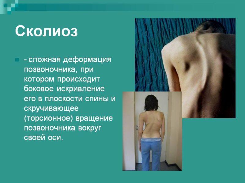 Что такое сухая вытяжка позвоночника