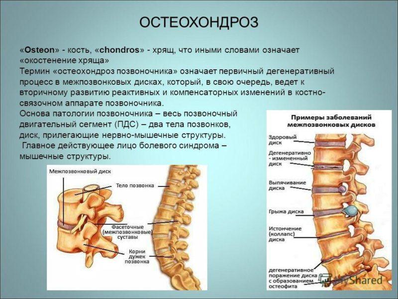 Что такое сухая вытяжка позвоночника