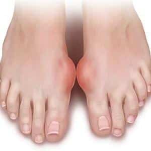 Как лечить воспаление суставов стопы