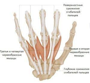 Что делать, если болит сустав кисти руки
