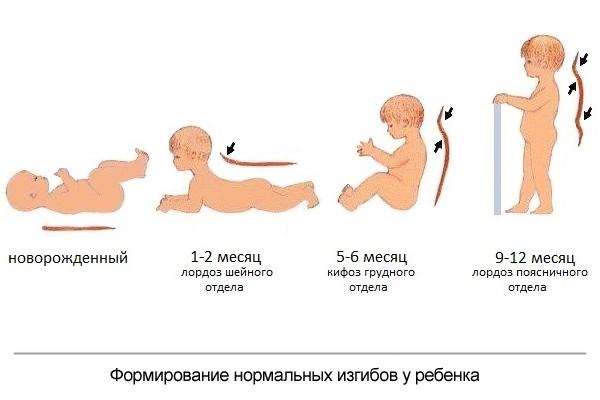 Что такое нарушение статики позвоночника