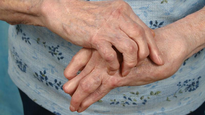 Как лечить хронический артрит