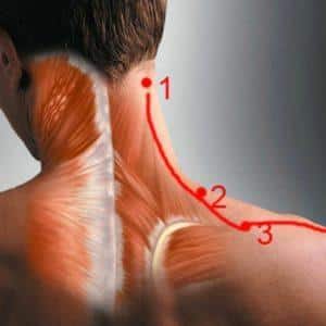 Что делать если потянул мышцу на шее