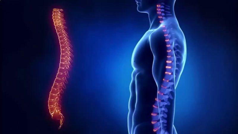 Как лечить сколиоз 3 степени