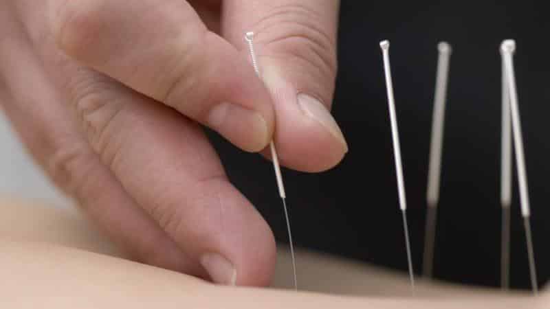 Как лечить синдром передней лестничной мышцы