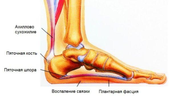 Как лечить бурсит голеностопного сустава