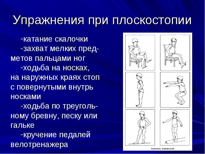 Гимнастика для стоп при плоскостопии у детей и взрослых