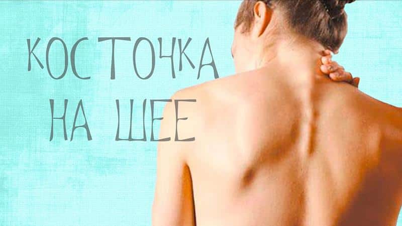 Что делать когда выпирает позвонок на шее