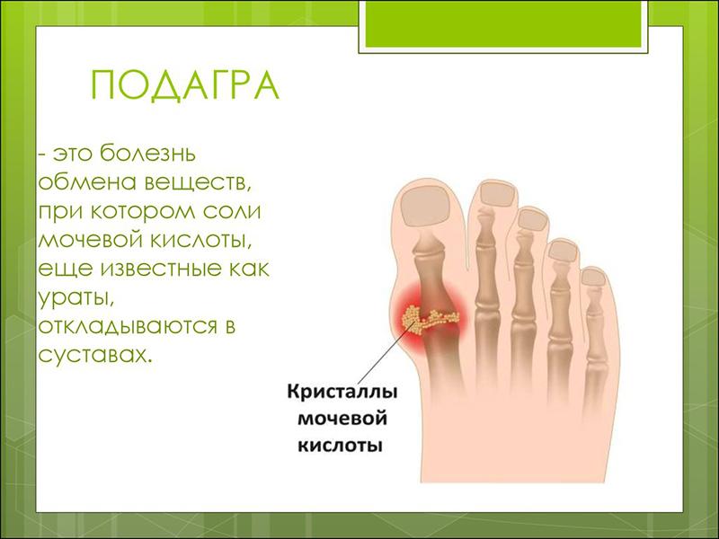 Психосоматика подагры