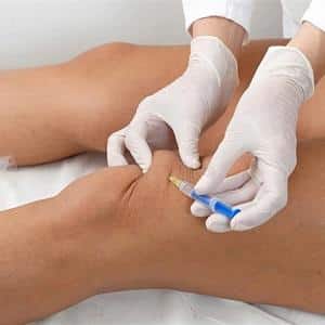 Остеопороз коленного сустава - симптомы и лечение