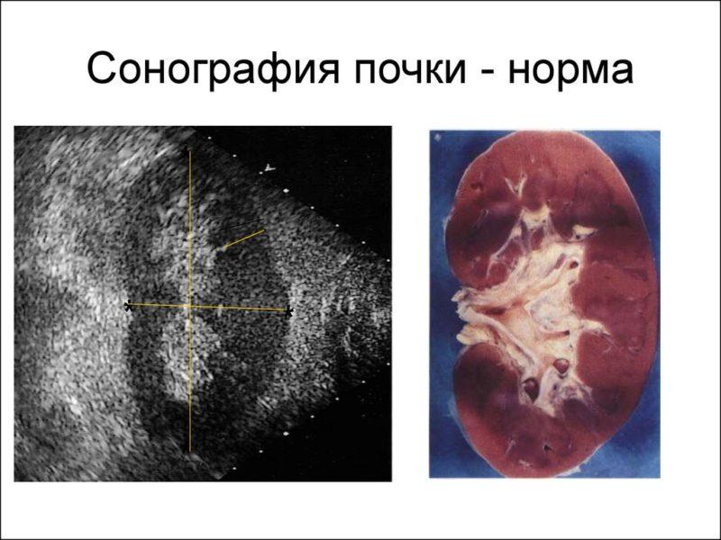Что такое сонография