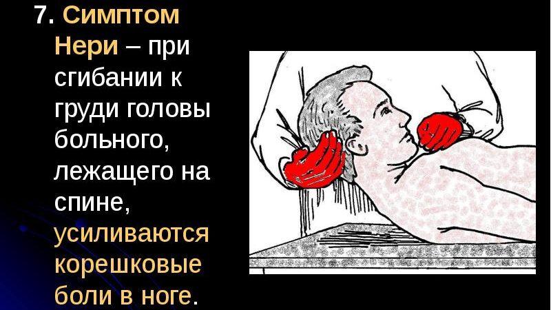 Как лечить синдром Нери при остеохондрозе